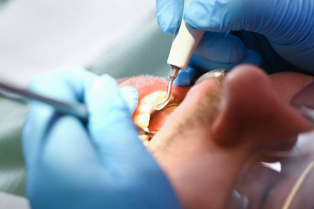 Best Emergency Dental Care for Abscessed Tooth in Forest City, NC