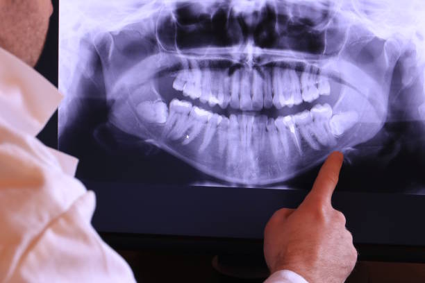 Best Emergency Root Canal Treatment in Forest City, NC