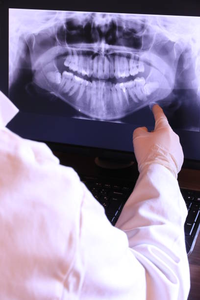 Best Emergency Dental Extractions in Forest City, NC